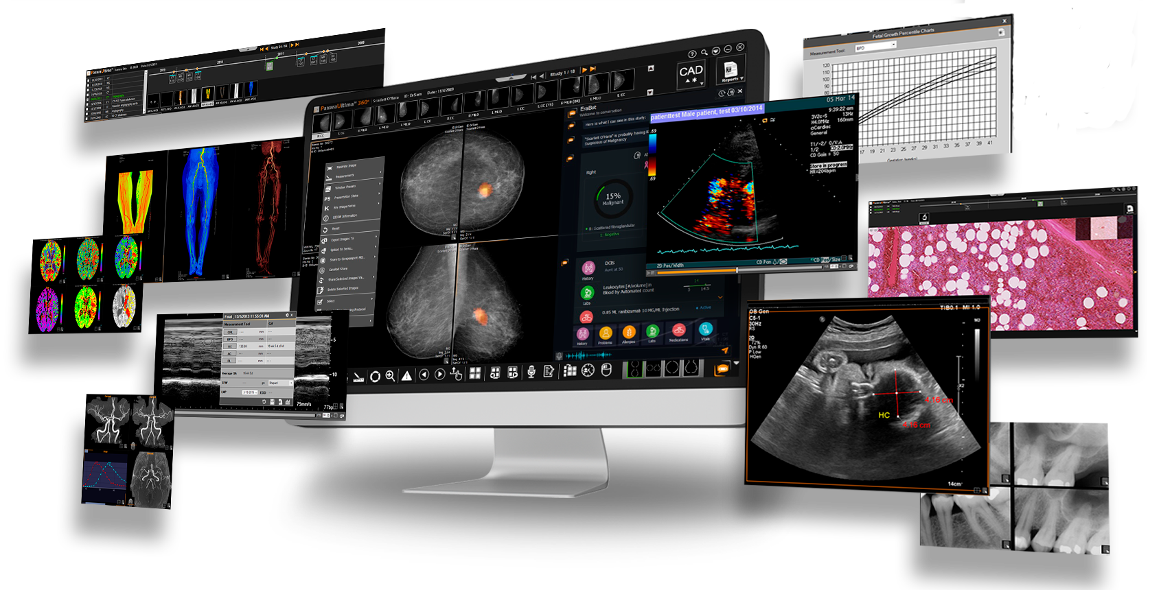 PaxeraHealth  PaxeraUltima UD300