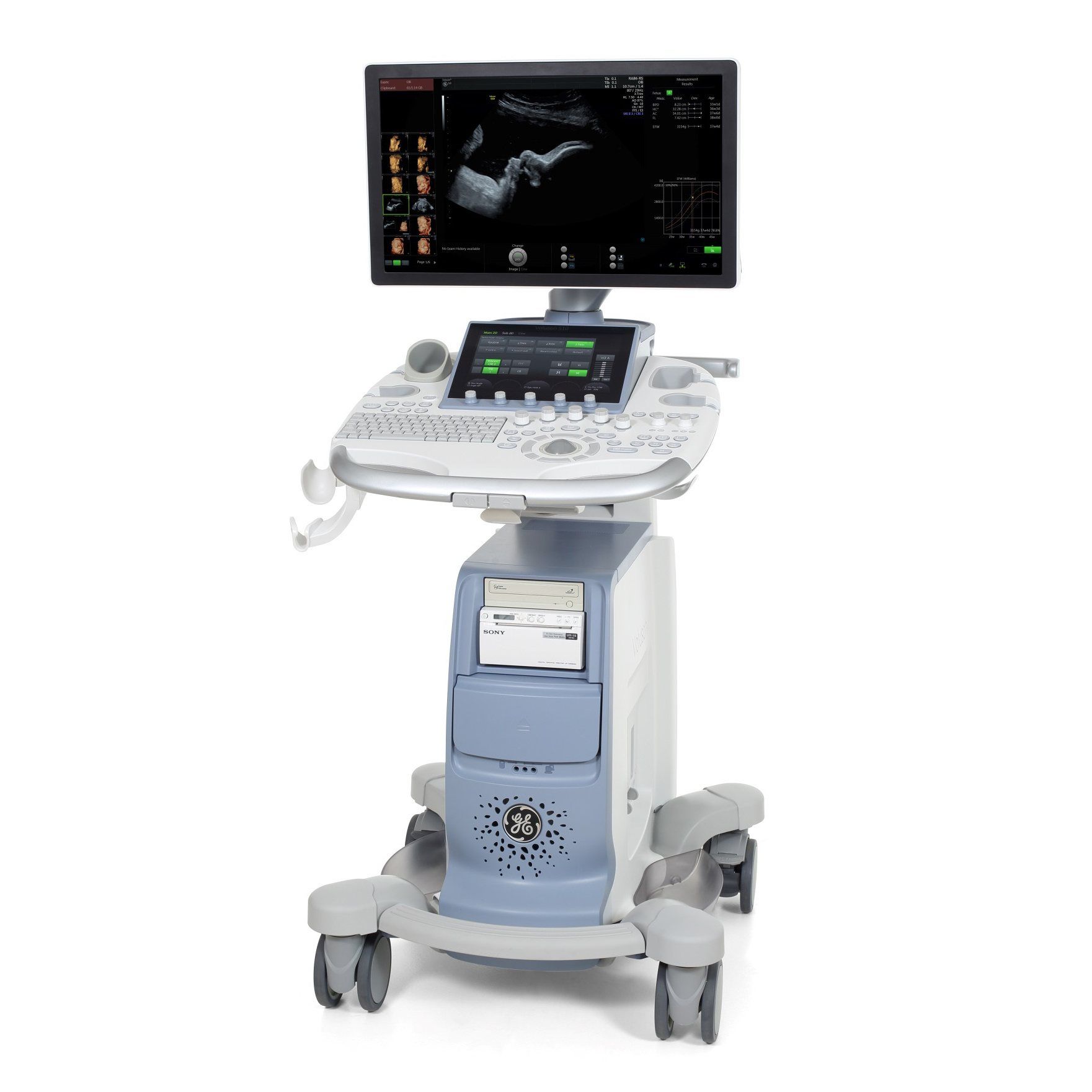 УЗИ аппарат (сканер) Voluson S10, GE Healthcare
